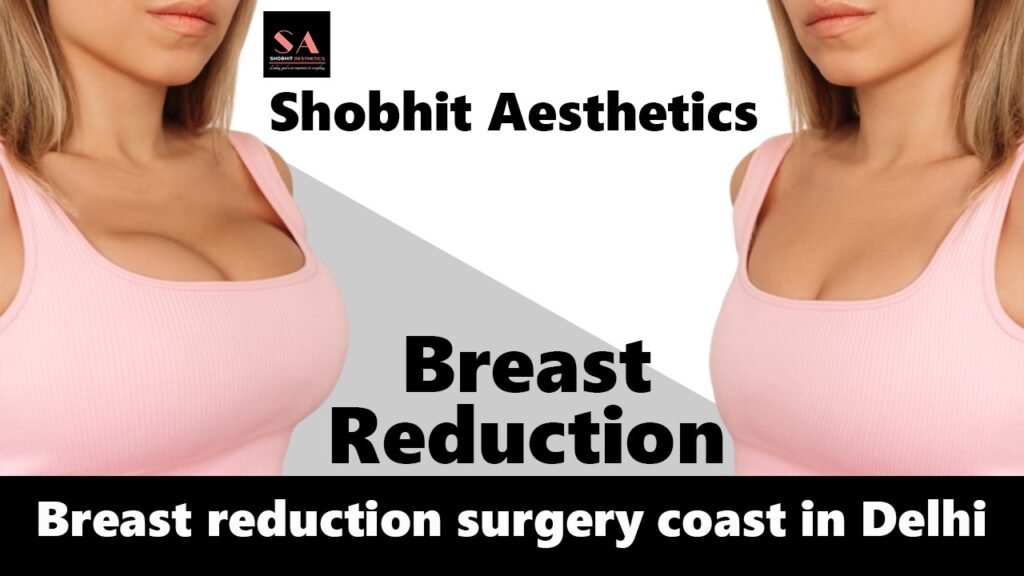 Breast Reduction Surgery