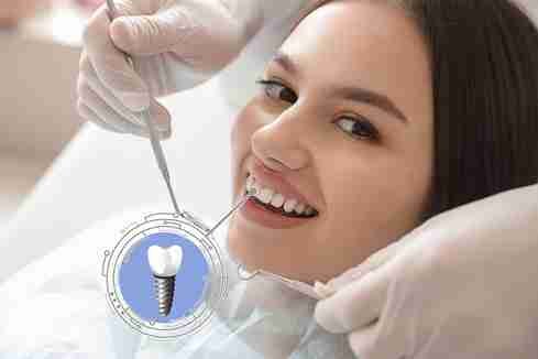 Choosing Immediate or Delayed Loading for Single Dental Implants